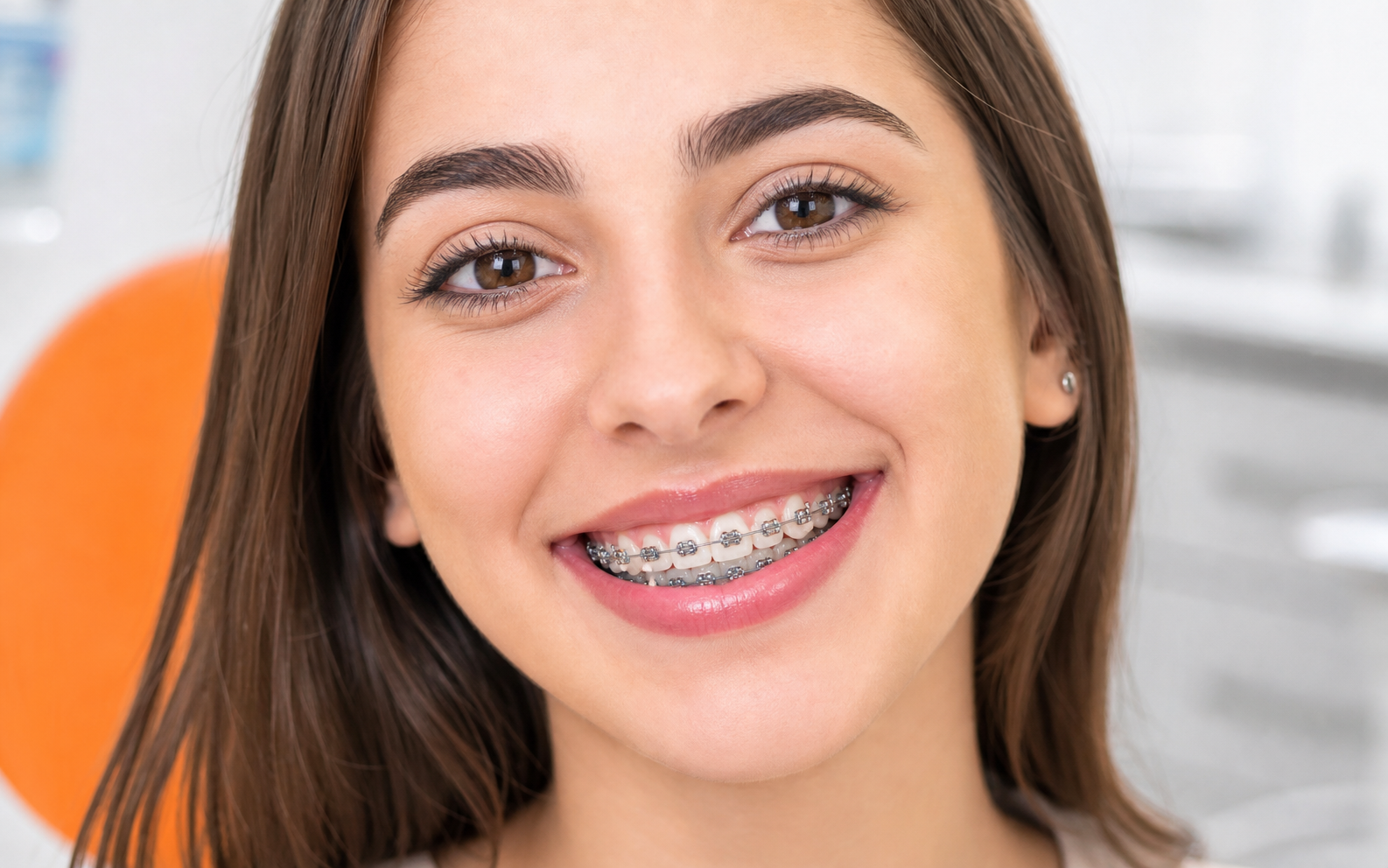 Braces gallery category